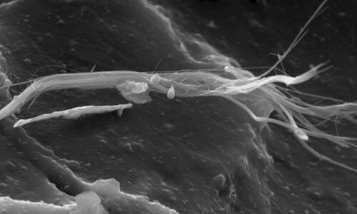 Adhesive on Flor-Flex board, asbestos fibers | © CRB Analyse Service GmbH