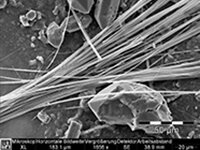 Immagine REM delle fibre di amianto | © CRB Analyse Service GmbH